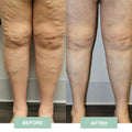 Whole-Body Massager™ (tas) - Gerät zur Linderung von Muskelschmerzen - Different Hero Banner 