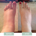 EMS-Regenerierendes Fußmassagegerät (bp)